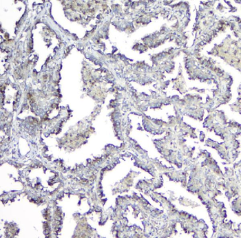 Anti-Mannose Phosphate Isomerase/MPI Antibody