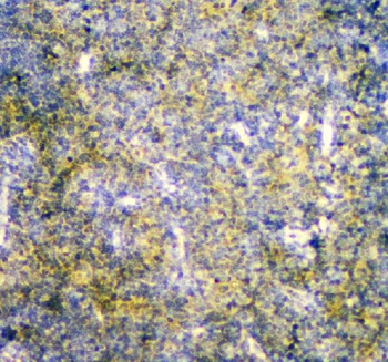 Anti-Mannose Phosphate Isomerase/MPI Antibody