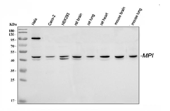Anti-Mannose Phosphate Isomerase/MPI Antibody