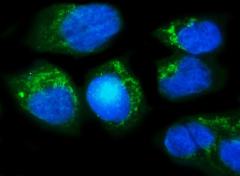 Anti-Methylmalonyl Coenzyme A mutase Antibody