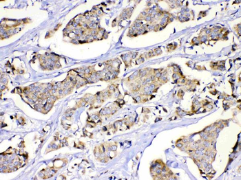 Anti-Methylmalonyl Coenzyme A mutase Antibody