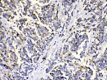 Anti-Methylmalonyl Coenzyme A mutase Antibody