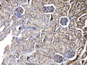 Anti-Nucleoside phosphorylase/PNP Antibody