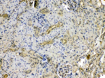 Anti-Nucleoside phosphorylase/PNP Antibody