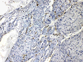Anti-Nucleoside phosphorylase/PNP Antibody