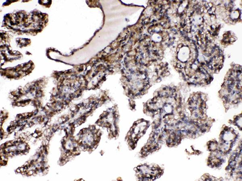 Anti-Nucleoside phosphorylase/PNP Antibody