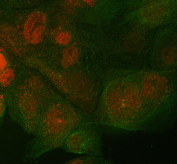 Anti-ST7 Antibody