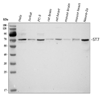Anti-ST7 Antibody