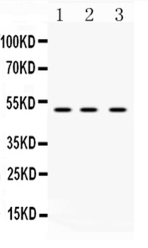 Anti-DR4/TNFRSF10A Antibody