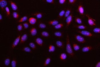 DR4/TNFRSF10A Antibody