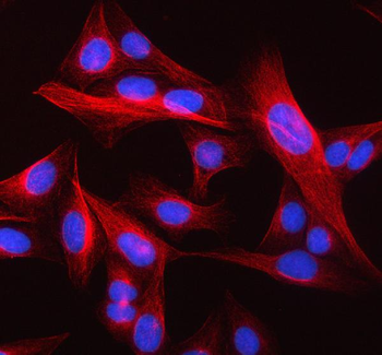 Anti-Beta Tubulin/TUBB Antibody