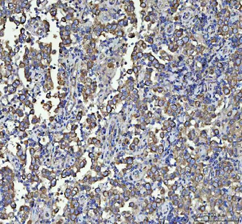 Anti-Beta Tubulin/TUBB Antibody