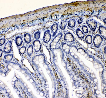 VASP Rabbit Polyclonal Antibody