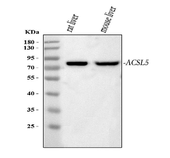 Anti-ACSL5 Antibody