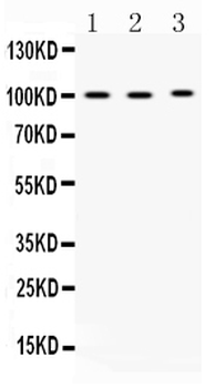 ADAM2 Rabbit Polyclonal Antibody