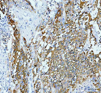 Anti-Anterior Gradient 2/AGR2 Antibody
