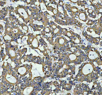 Anti-Anterior Gradient 2/AGR2 Antibody