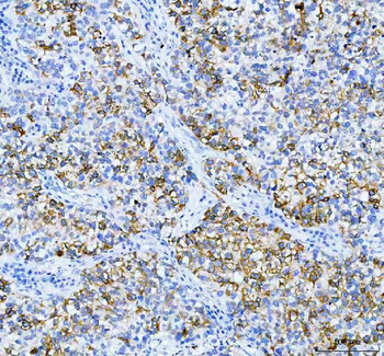 Anti-Anterior Gradient 2/AGR2 Antibody