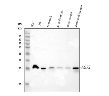 Anti-Anterior Gradient 2/AGR2 Antibody