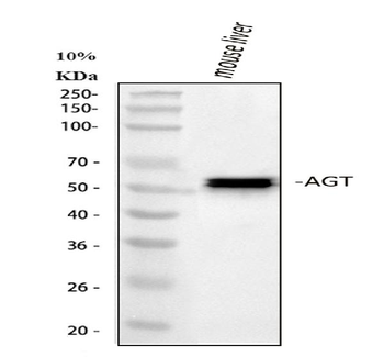 Anti-Angiotensinogen/AGT Antibody