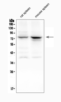 12 Lipoxygenase/ALOX12 Antibody