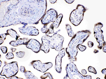 Anti-Angiopoietin-2/ANGPT2 Antibody