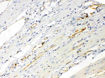 Anti-ANGPTL2 Antibody