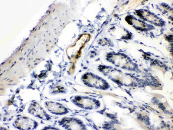 Anti-ANGPTL2 Antibody