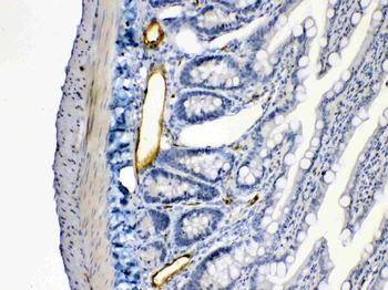 Anti-ANGPTL2 Antibody