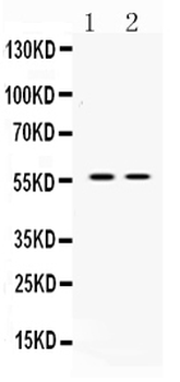 Anti-ANGPTL2 Antibody
