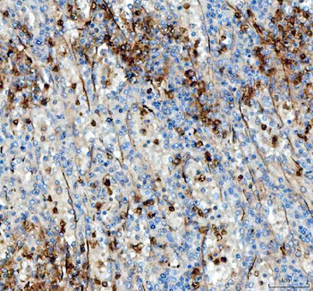 Anti-Angiopoietin-like 4/ANGPTL4 Antibody