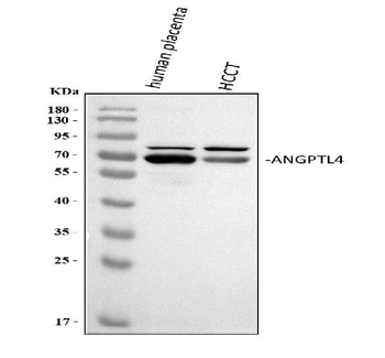 Anti-Angiopoietin-like 4/ANGPTL4 Antibody