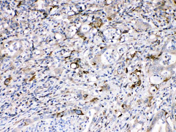 Anti-Bax Antibody