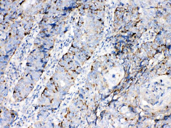 Anti-Bax Antibody