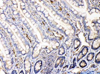 Anti-Bax Antibody