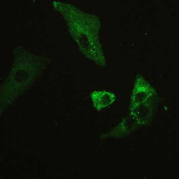 Anti-CD147/Emmprin/BSG Antibody