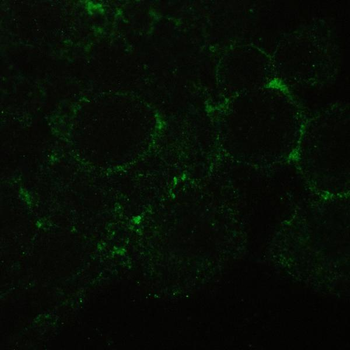 Anti-CD147/Emmprin/BSG Antibody