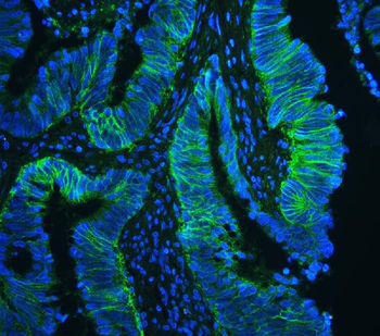 Anti-CD147/Emmprin/BSG Antibody