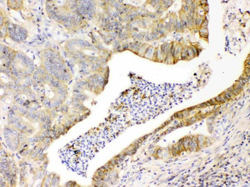 Anti-CD147/Emmprin/BSG Antibody