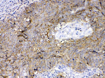 Anti-CD147/Emmprin/BSG Antibody