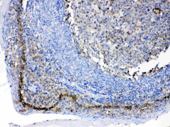 Anti-CD147/Emmprin/BSG Antibody