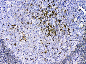 Superoxide Dismutase 4/CCS Rabbit Polyclonal Antibody