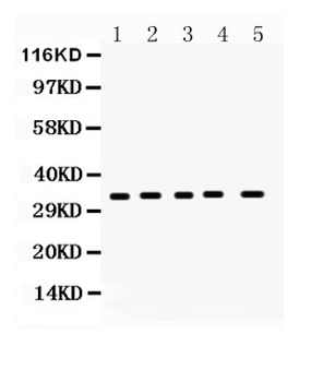 Superoxide Dismutase 4/CCS Rabbit Polyclonal Antibody