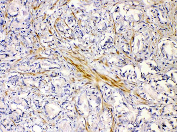 Anti-Nicotinic Acetylcholine Receptor alpha 5/CHRNA5 Antibody