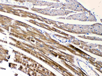 Anti-Nicotinic Acetylcholine Receptor alpha 5/CHRNA5 Antibody