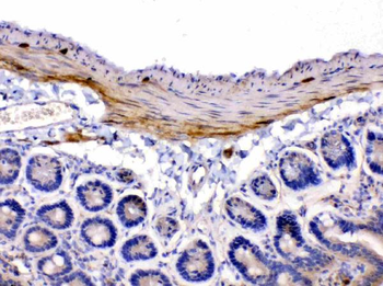 Anti-Nicotinic Acetylcholine Receptor alpha 5/CHRNA5 Antibody