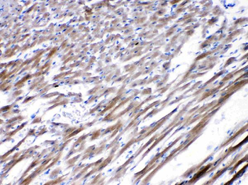 Anti-Nicotinic Acetylcholine Receptor alpha 5/CHRNA5 Antibody
