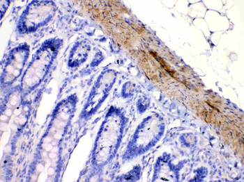Anti-Nicotinic Acetylcholine Receptor alpha 5/CHRNA5 Antibody
