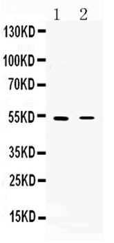 Anti-Nicotinic Acetylcholine Receptor alpha 5/CHRNA5 Antibody