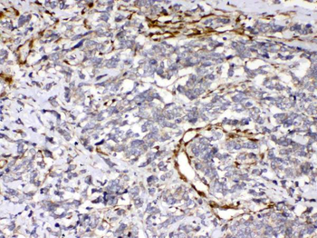 Anti-Cytoglobin/CYGB Antibody